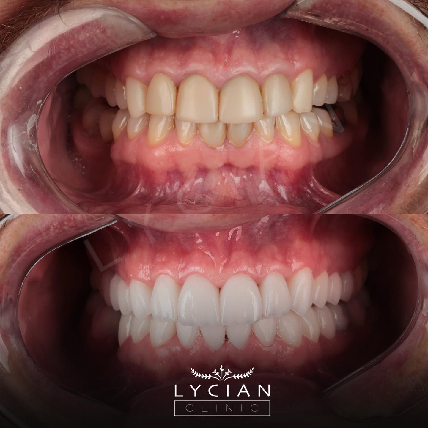 lycianclinic_328224401_112113241702827_3312292931104386015_n