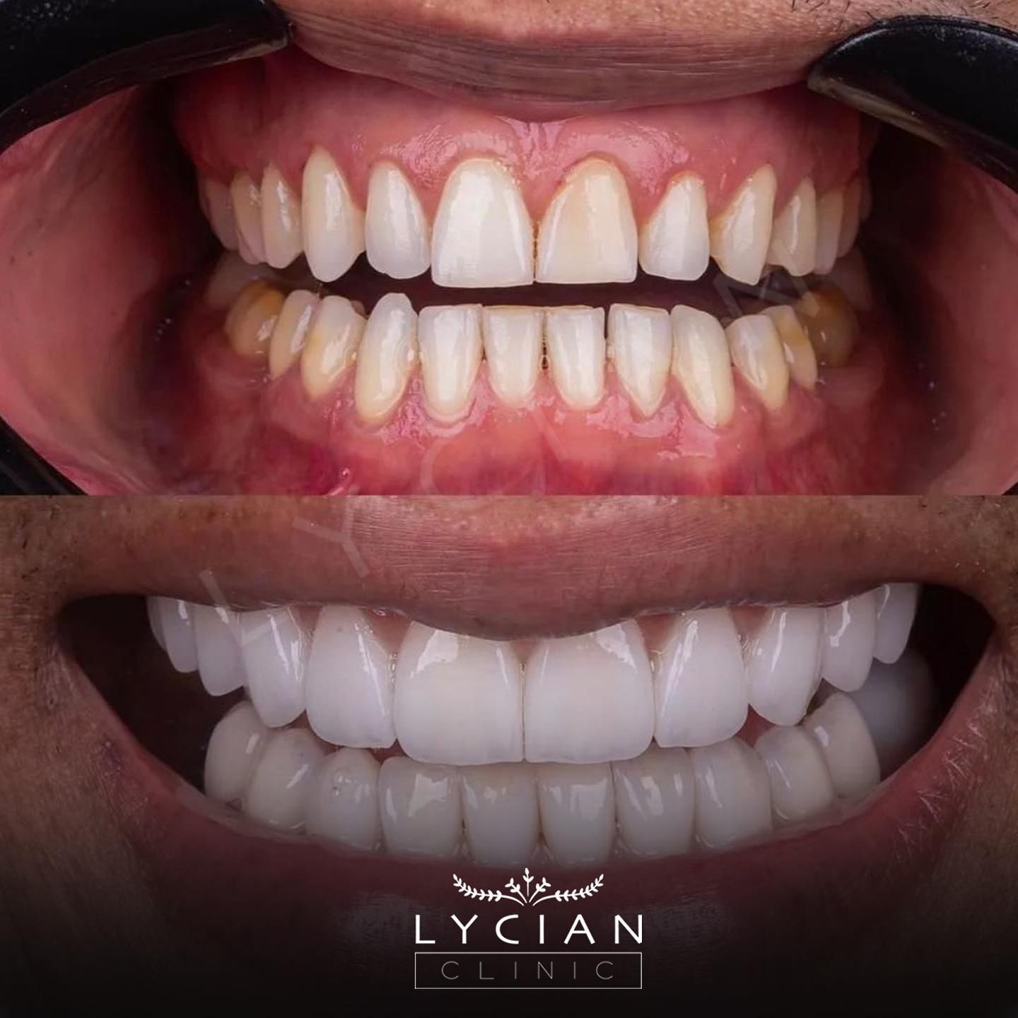 lycianclinic_337161990_757989409223098_4725488757509250080_n