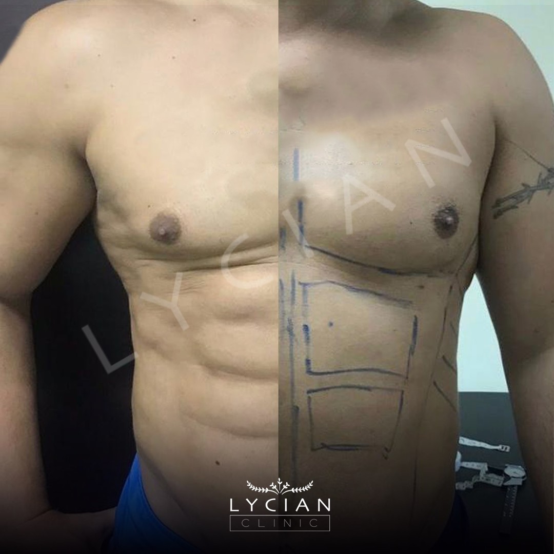 lycianclinic_241800686_2649935105301996_6864795401020092966_n