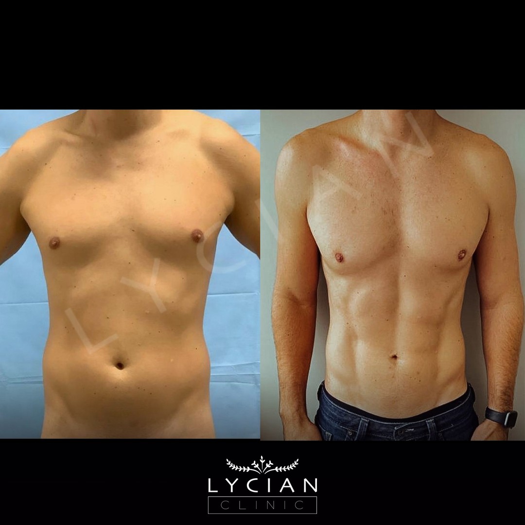 lycianclinic_242594909_1217639148739426_2845281437893434248_n