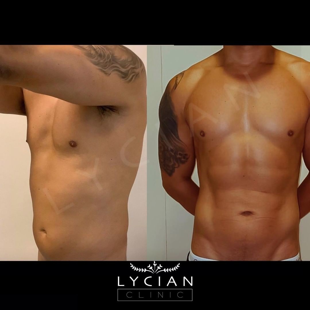 lycianclinic_244600061_133303019044285_1634295660247968215_n