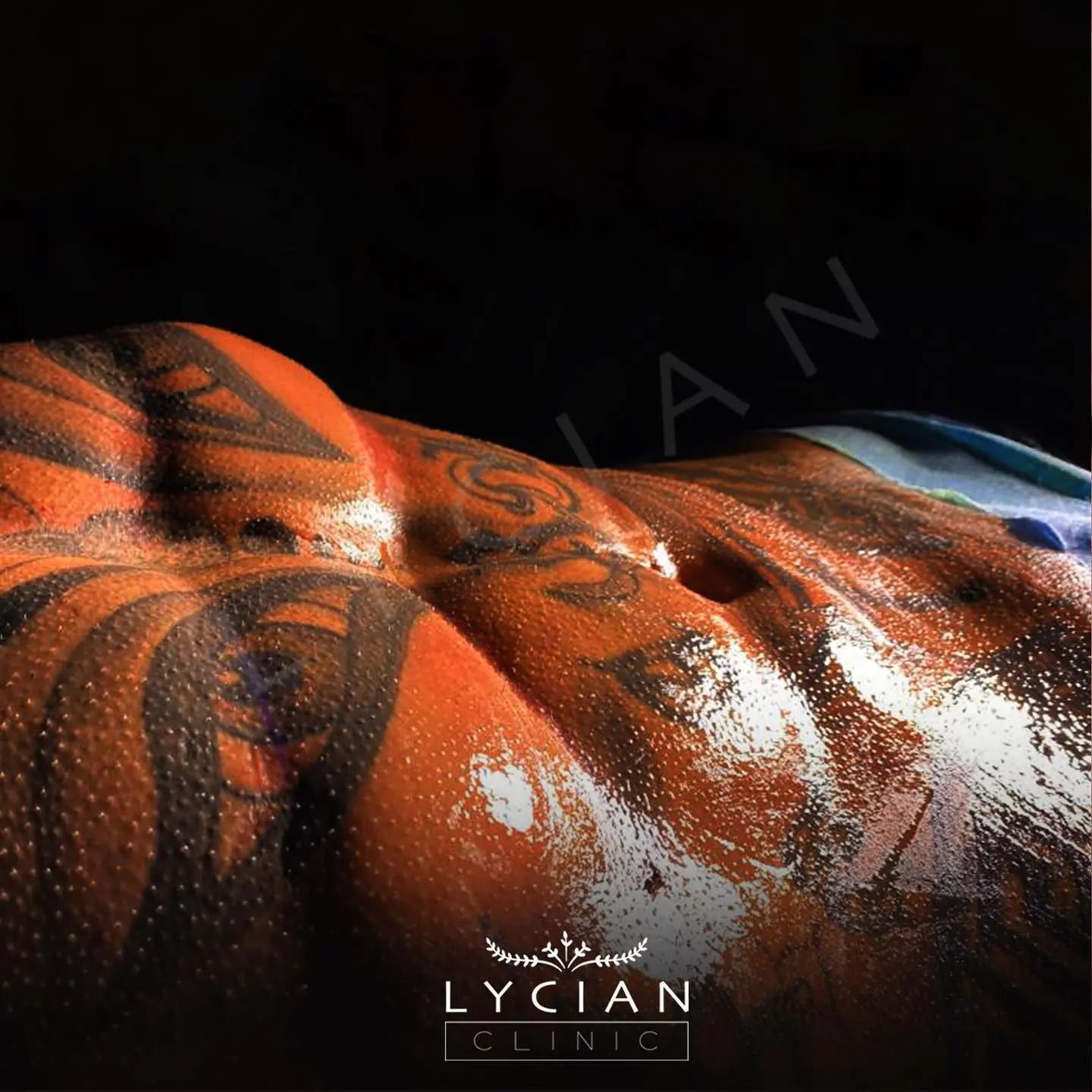 lycianclinic_352415796_557139896610580_2037207580832428074_n