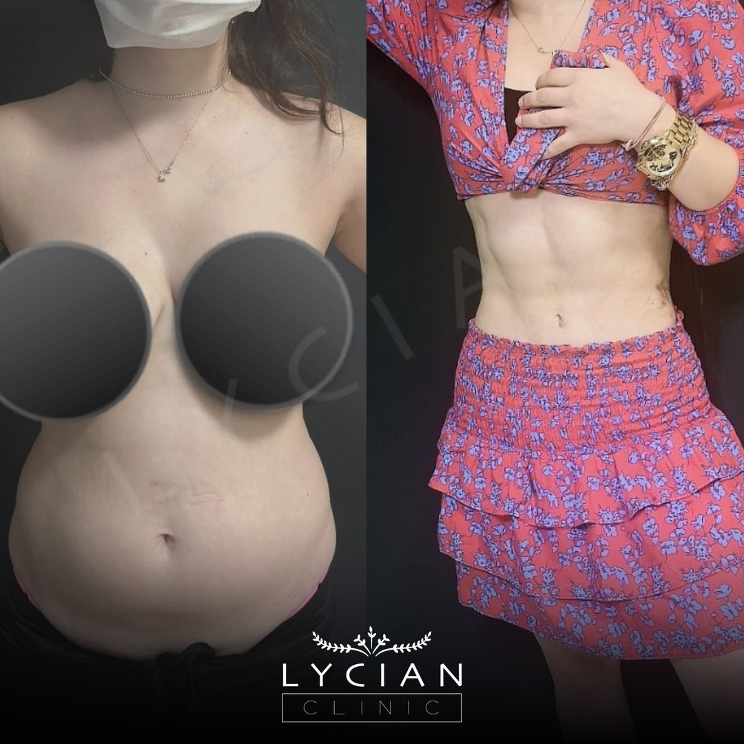 lycianclinic_241124191_359747149159536_1153834526658497805_n